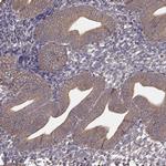 ERp57 Antibody in Immunohistochemistry (Paraffin) (IHC (P))