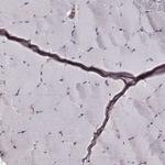 ERp57 Antibody in Immunohistochemistry (Paraffin) (IHC (P))