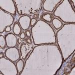 ERp57 Antibody in Immunohistochemistry (Paraffin) (IHC (P))