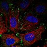 Zyxin Antibody in Immunocytochemistry (ICC/IF)