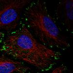 Zyxin Antibody in Immunocytochemistry (ICC/IF)
