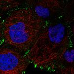 Zyxin Antibody in Immunocytochemistry (ICC/IF)