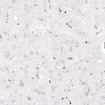 Zyxin Antibody in Immunohistochemistry (Paraffin) (IHC (P))