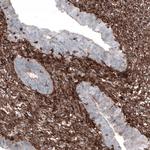 Zyxin Antibody in Immunohistochemistry (Paraffin) (IHC (P))
