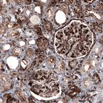 Zyxin Antibody in Immunohistochemistry (Paraffin) (IHC (P))