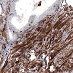 Zyxin Antibody in Immunohistochemistry (Paraffin) (IHC (P))