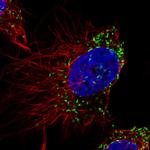 PMP70 Monoclonal Antibody (CL2524)