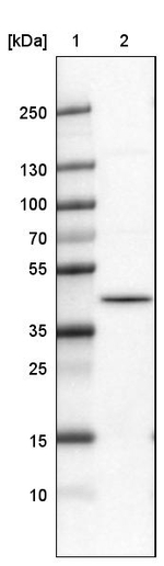 hnRNP C Antibody in Western Blot (WB)