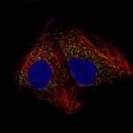 ACAA1 Antibody in Immunocytochemistry (ICC/IF)