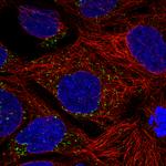 ACAA1 Antibody in Immunocytochemistry (ICC/IF)