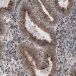 ACAA1 Antibody in Immunohistochemistry (Paraffin) (IHC (P))