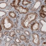 ACAA1 Antibody in Immunohistochemistry (Paraffin) (IHC (P))