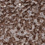ACAA1 Antibody in Immunohistochemistry (Paraffin) (IHC (P))