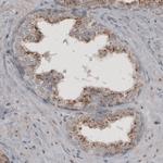 ACAA1 Antibody in Immunohistochemistry (Paraffin) (IHC (P))