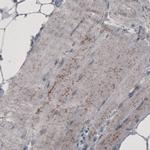 ACAA1 Antibody in Immunohistochemistry (Paraffin) (IHC (P))