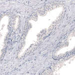 CNPase Antibody in Immunohistochemistry (Paraffin) (IHC (P))