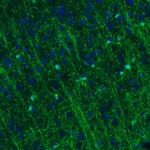 CNPase Antibody in Immunohistochemistry (Paraffin) (IHC (P))