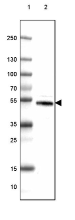 DOPA Decarboxylase Antibody in Western Blot (WB)