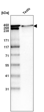 Laminin alpha-1 Antibody in Western Blot (WB)