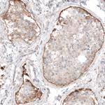 Laminin alpha-1 Antibody in Immunohistochemistry (Paraffin) (IHC (P))