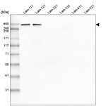 Laminin alpha-1 Antibody in Western Blot (WB)