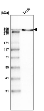 Laminin alpha-1 Antibody in Western Blot (WB)