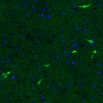 ChAT Antibody in Immunohistochemistry (Paraffin) (IHC (P))
