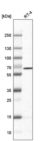 PGM1 Antibody in Western Blot (WB)