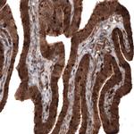 Profilin 1 Antibody in Immunohistochemistry (Paraffin) (IHC (P))