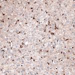 Profilin 1 Antibody in Immunohistochemistry (Paraffin) (IHC (P))