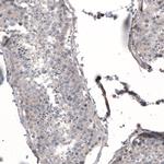 Profilin 1 Antibody in Immunohistochemistry (Paraffin) (IHC (P))