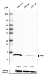 Profilin 1 Antibody in Western Blot (WB)