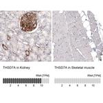 THSD7A Antibody