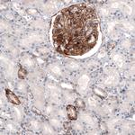 THSD7A Monoclonal Antibody (CL3778)