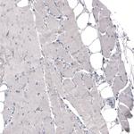 THSD7A Antibody in Immunohistochemistry (Paraffin) (IHC (P))