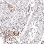 THSD7A Antibody in Immunohistochemistry (Paraffin) (IHC (P))