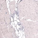 THSD7A Antibody in Immunohistochemistry (Paraffin) (IHC (P))