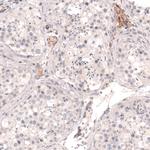 THSD7A Antibody in Immunohistochemistry (Paraffin) (IHC (P))
