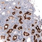 ACE2 Antibody in Immunohistochemistry (Paraffin) (IHC (P))