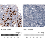 ACE2 Monoclonal Antibody (CL4013)