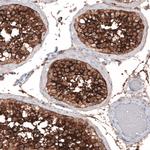ACE2 Antibody in Immunohistochemistry (Paraffin) (IHC (P))