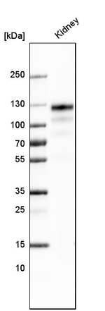 ACE2 Antibody in Western Blot (WB)
