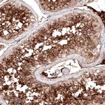 ACE2 Antibody in Immunohistochemistry (Paraffin) (IHC (P))