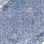 ACE2 Antibody in Immunohistochemistry (Paraffin) (IHC (P))