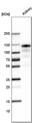 ACE2 Antibody in Western Blot (WB)