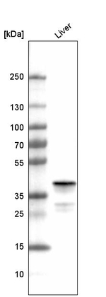 OTC Antibody in Western Blot (WB)