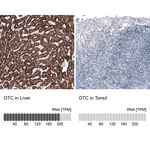 OTC Antibody in Immunohistochemistry (Paraffin) (IHC (P))