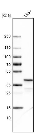 OTC Antibody in Western Blot (WB)