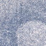 PRRT2 Monoclonal Antibody (CL4233)