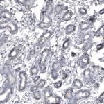 MKL1 Antibody in Immunohistochemistry (Paraffin) (IHC (P))